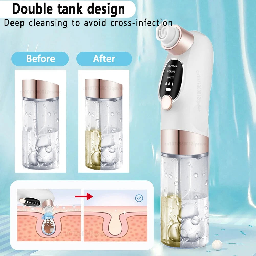 Pore Cleansing Device for Effortless Skin Renewal