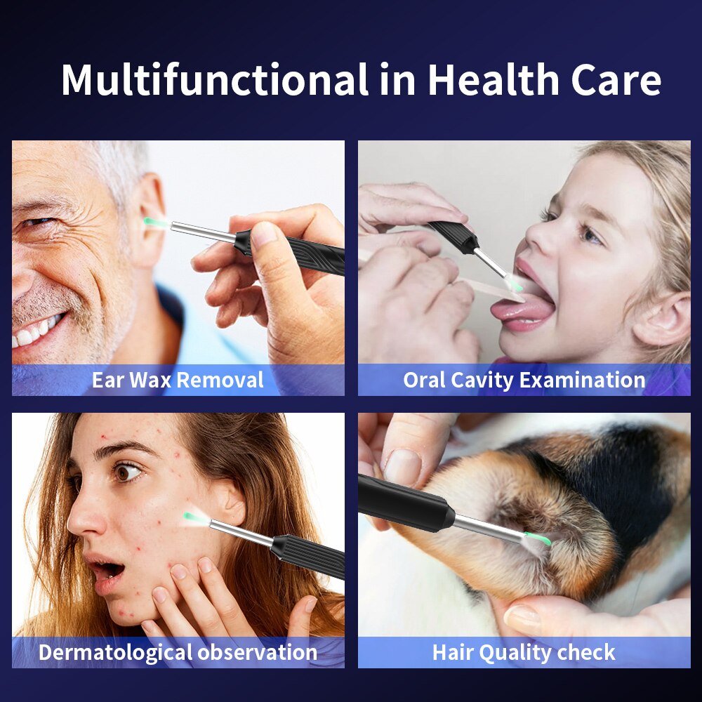 Smart Ear Cleaning Tool with Camera Integration
