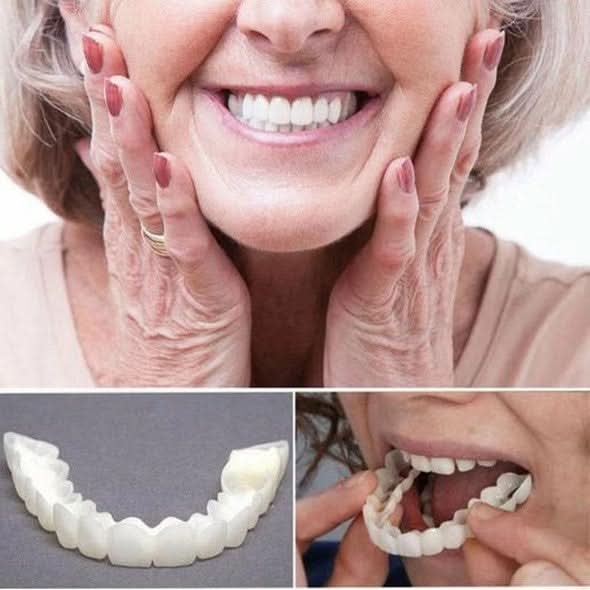 SmileBright – Complete Dual Veneer Set for Instant Confidence