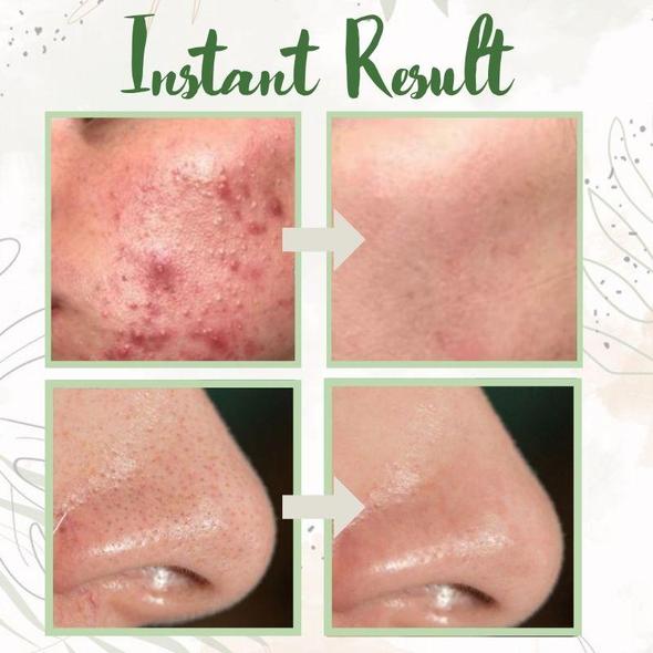Revitalizing Green Essence Clay Mask Stick