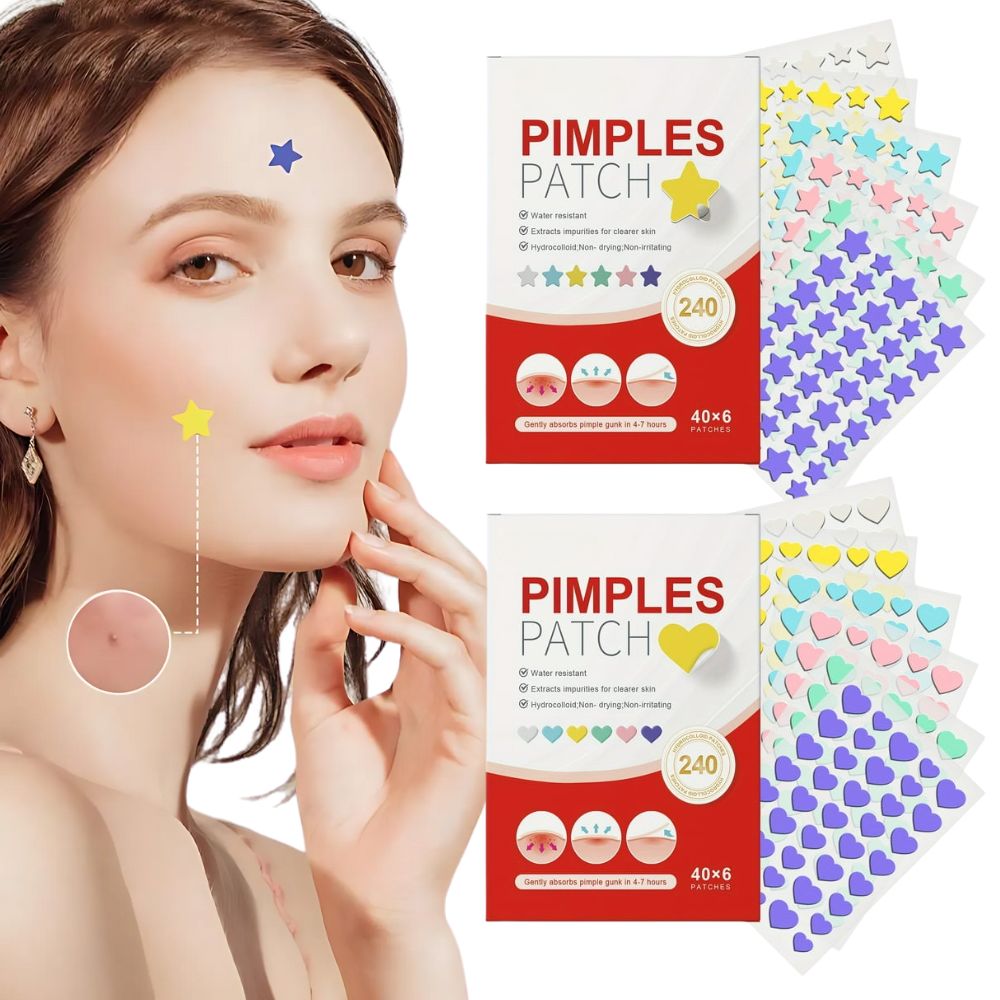 240 Adorable Acne Solutions for Radiant Skin