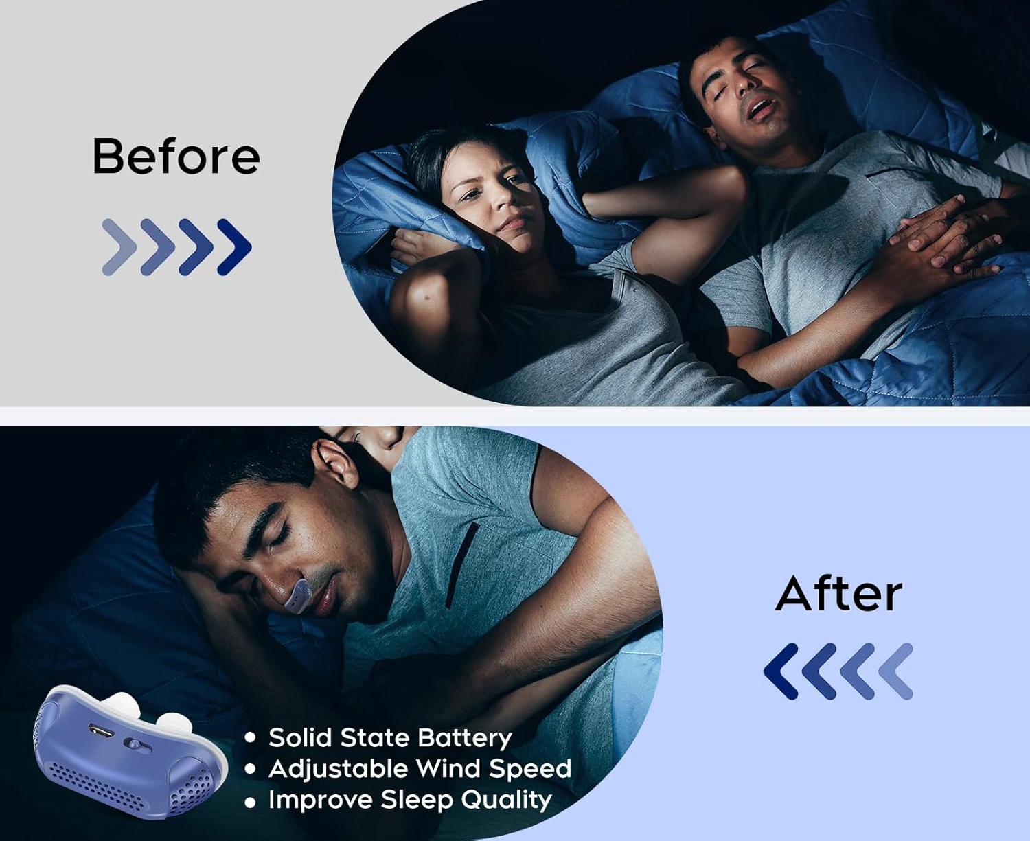 SnoreGuard Compact Nasal Device – Lightweight Travel Sleep Aid