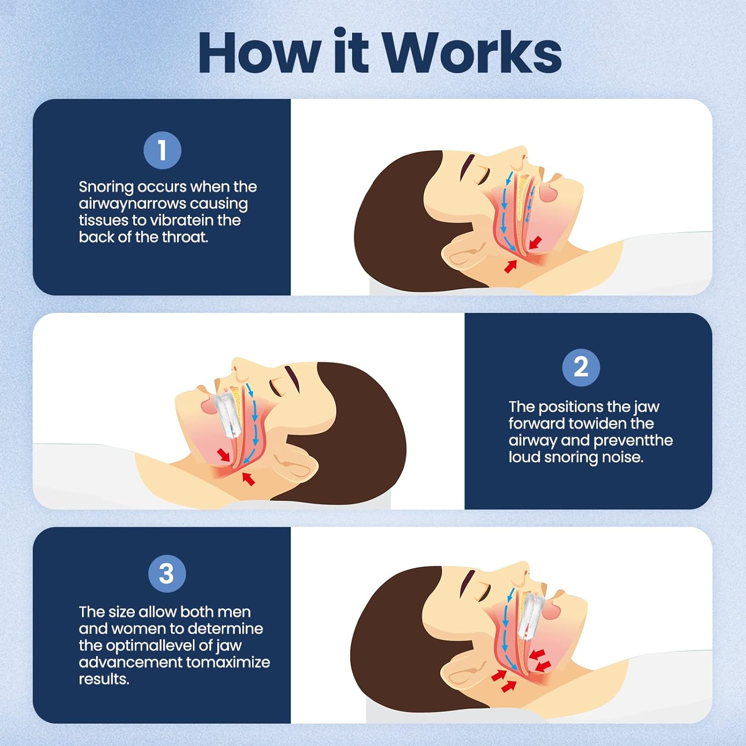 Snore-Free Sleep Solution Mouthpiece for Better Rest