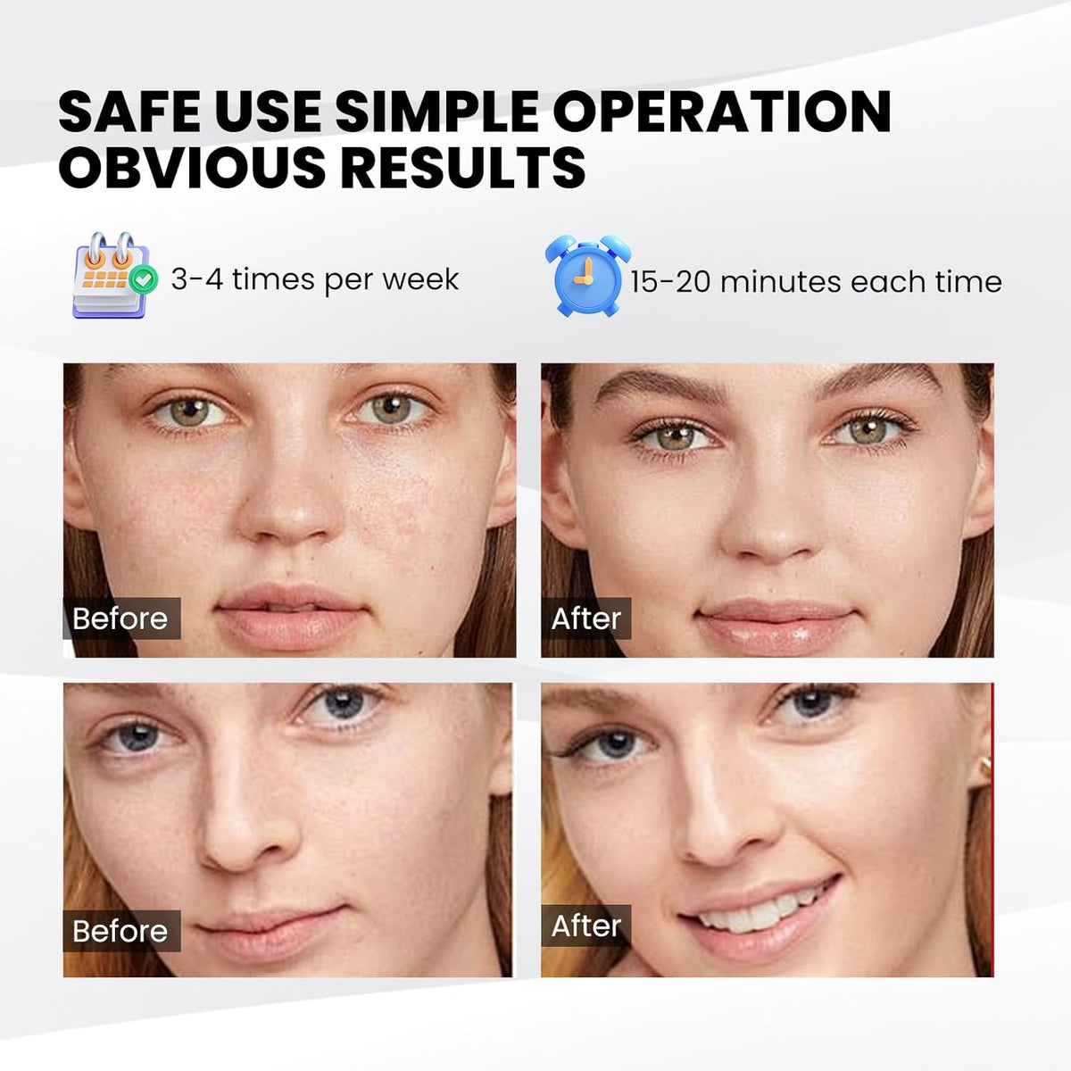 SpaGlow LED Facial Treatment Mask
