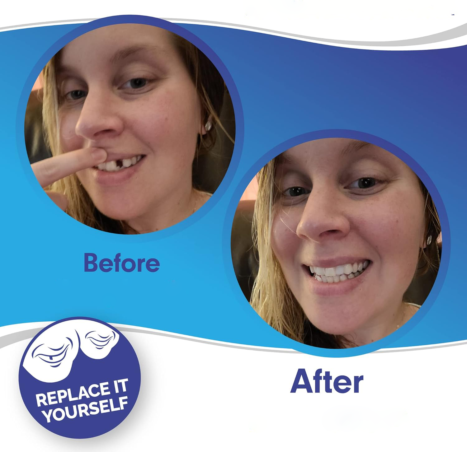 SmileSnap Clip-On Veneers – Effortless Cosmetic Teeth Cover for Instant Smile Boost