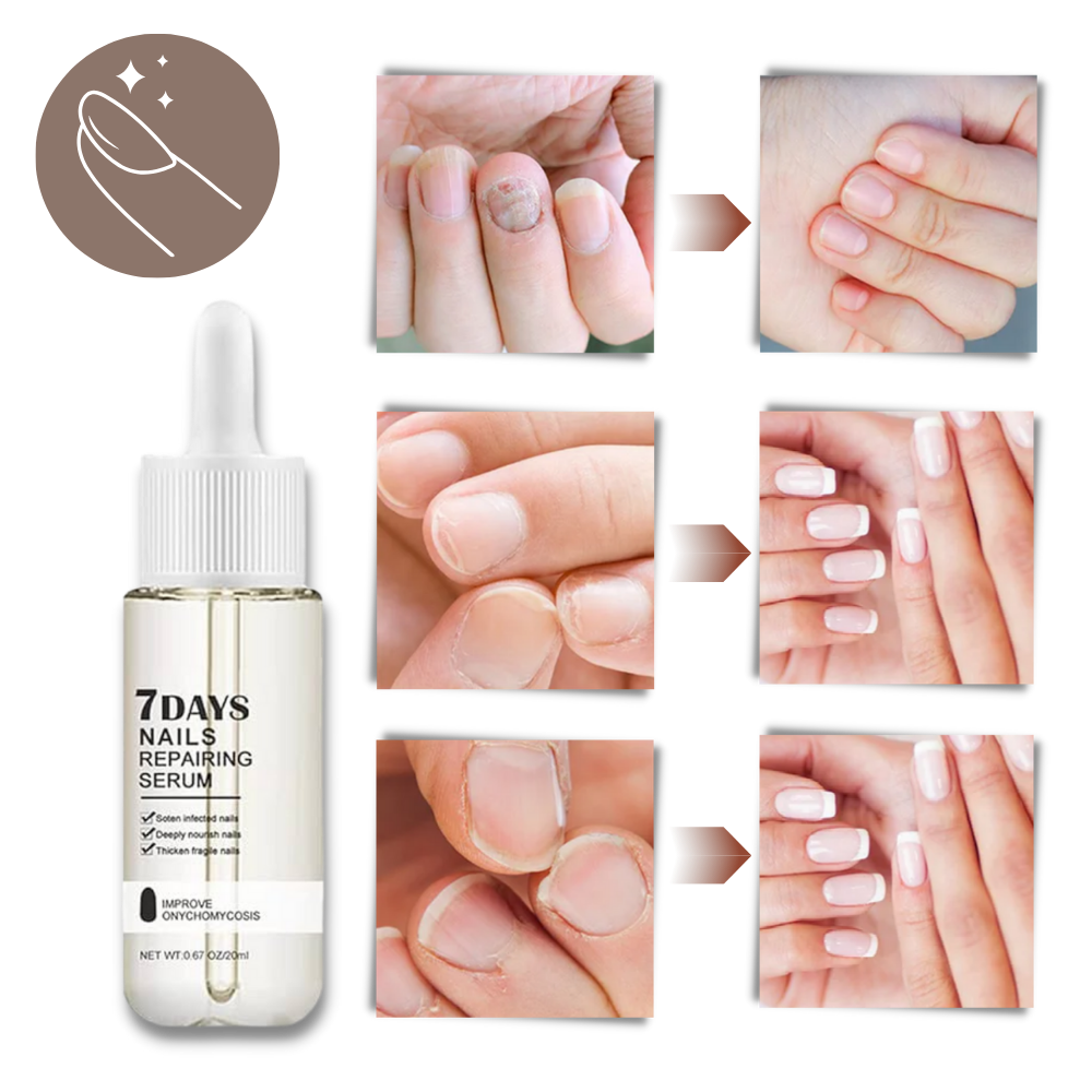 Nail Revival Serum for Stronger, Healthier Nails