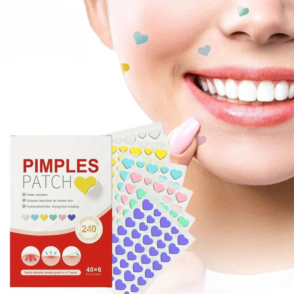 240 Adorable Acne Solutions for Radiant Skin