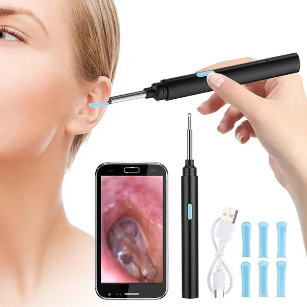 Smart Ear Health Monitor for Effective Wax Removal