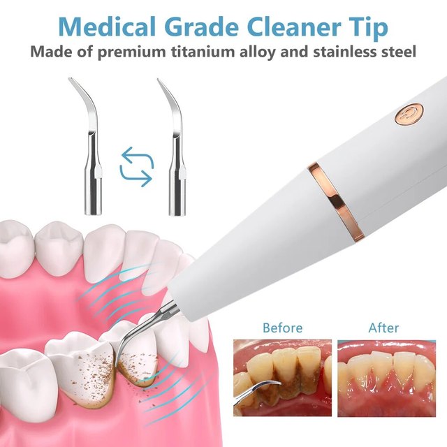 Smart Sonic Tooth Cleaner: Safe, Quick, and Effective Home Care