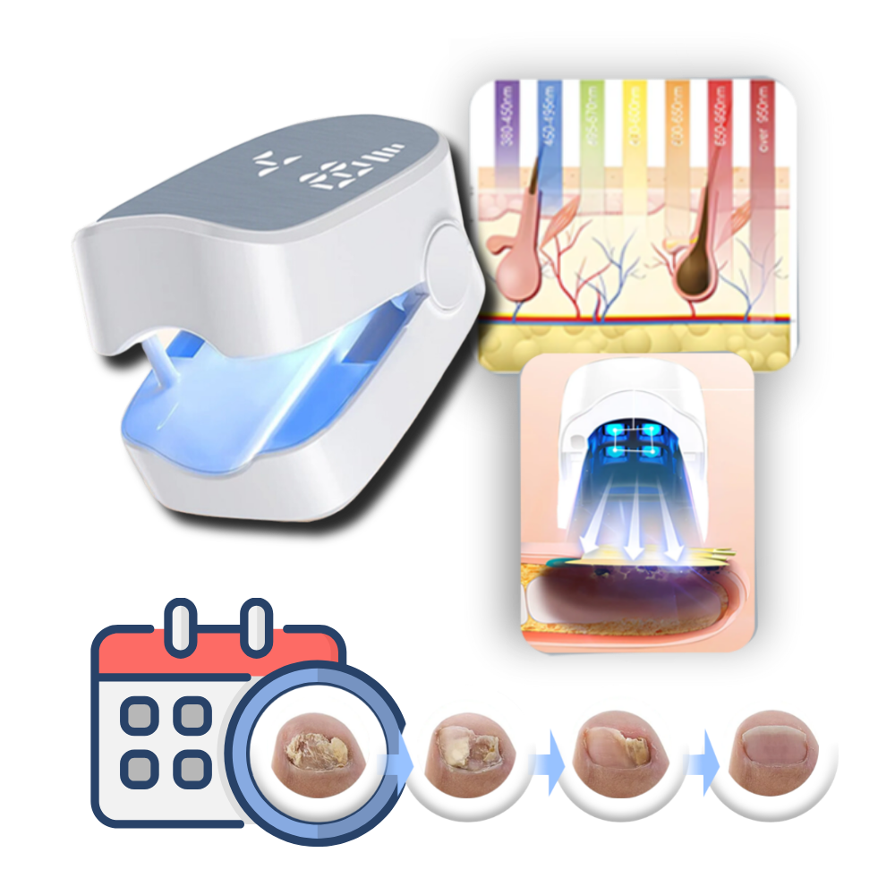 Pain-Free Laser Treatment for Nail Health Enhancement