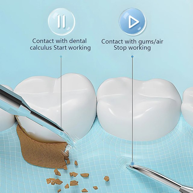 Smart Sonic Tooth Cleaner: Safe, Quick, and Effective Home Care