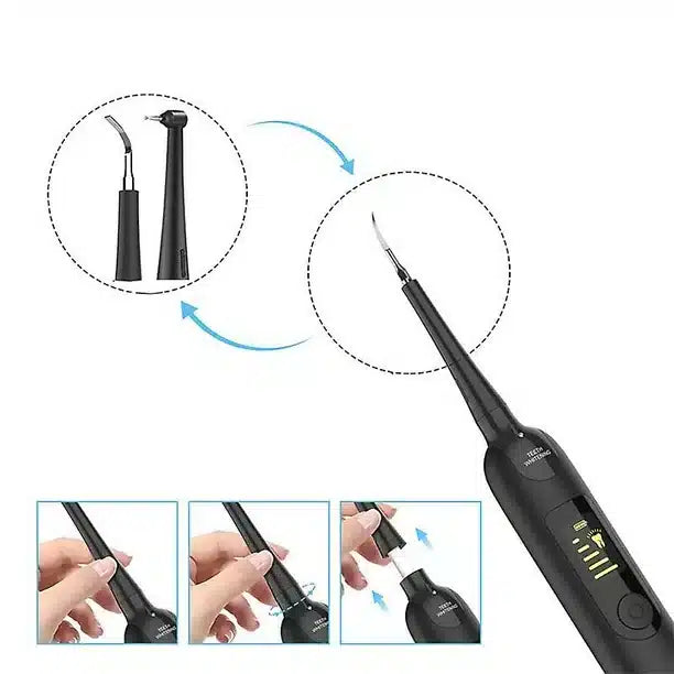 Home Dental Hygiene and Tartar Removal Kit