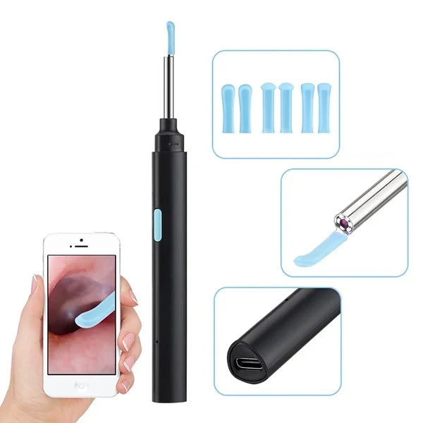 Smart Ear Health Monitor for Effective Wax Removal