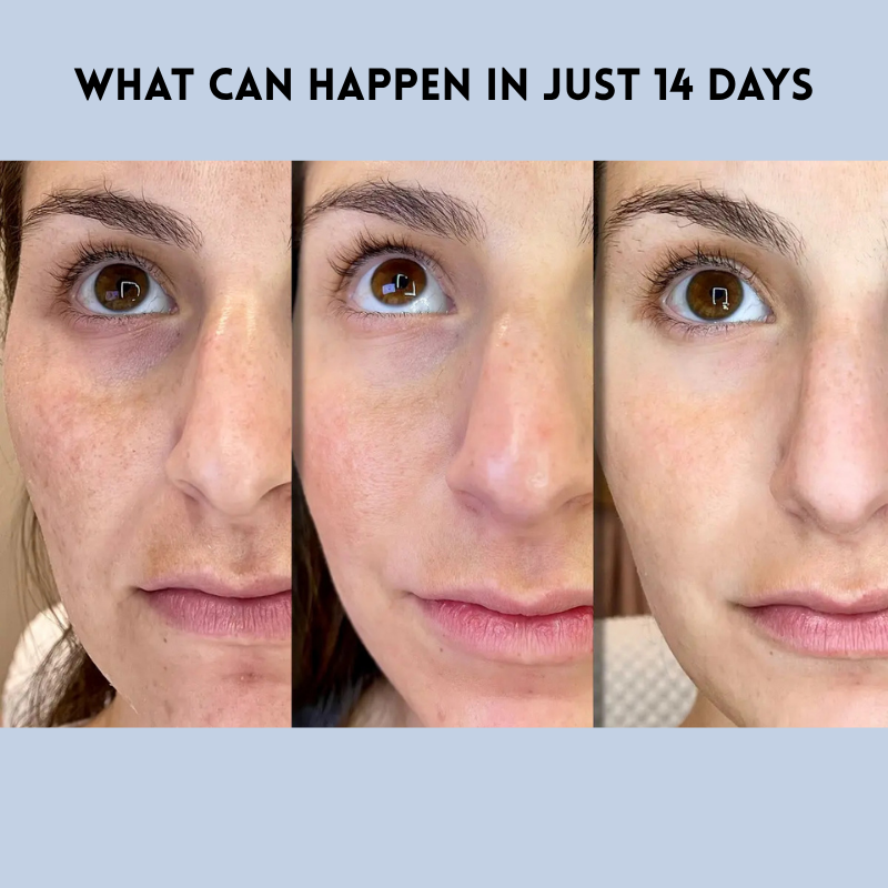 Anti-Aging Serum Pain-Free Face Eyes & Forehead