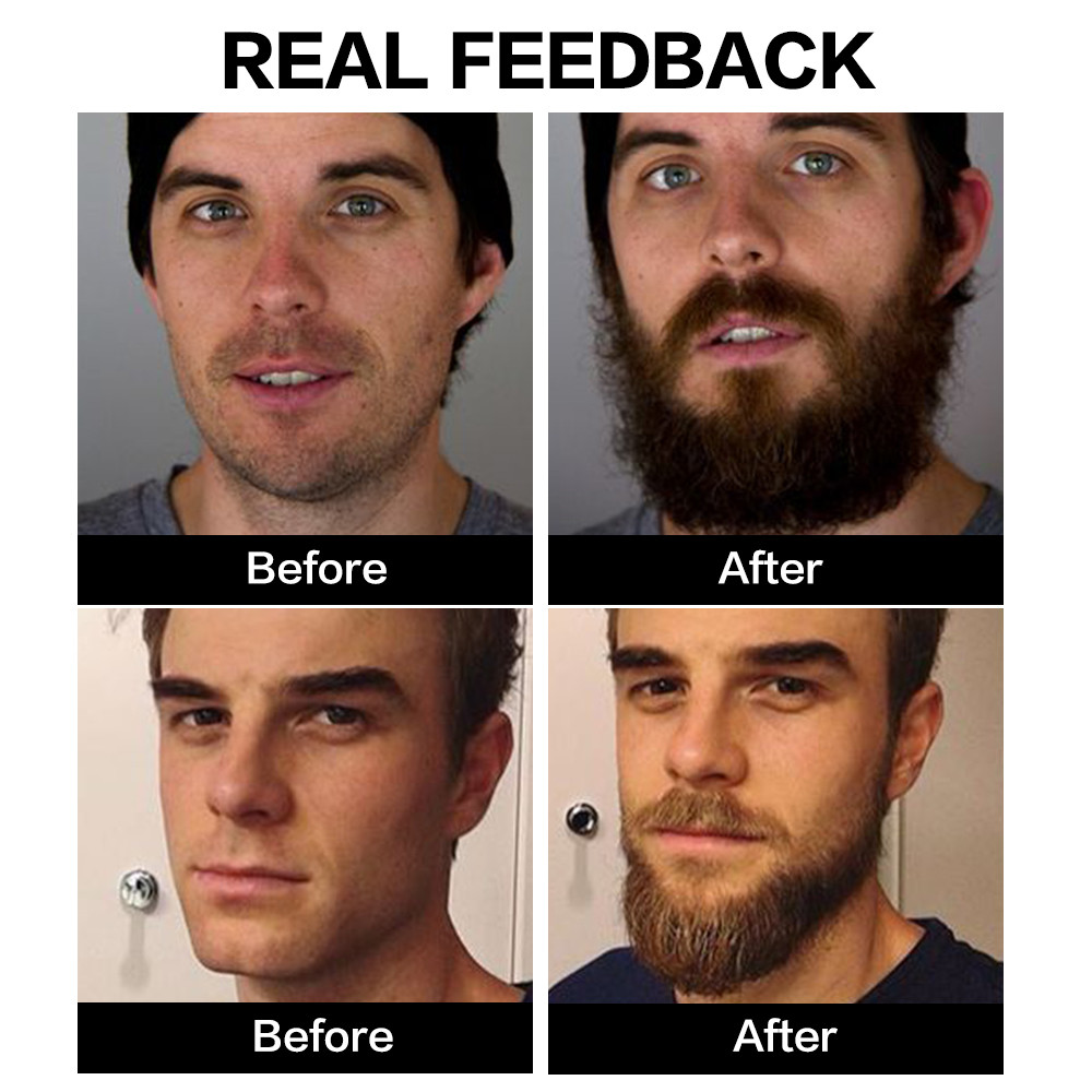 Beard Oil Natural Growth & Ingrown Hair Defense