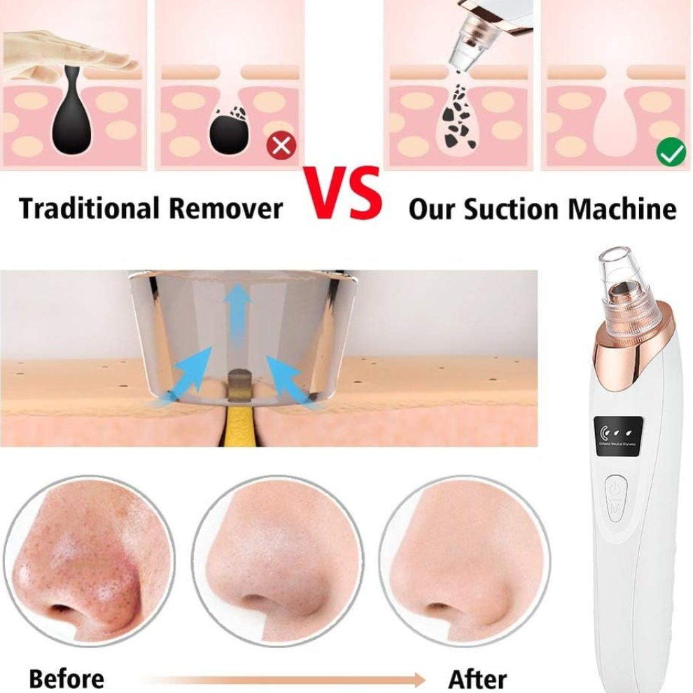 Blackhead Remover Rechargeable Suction & Interchangeable Heads