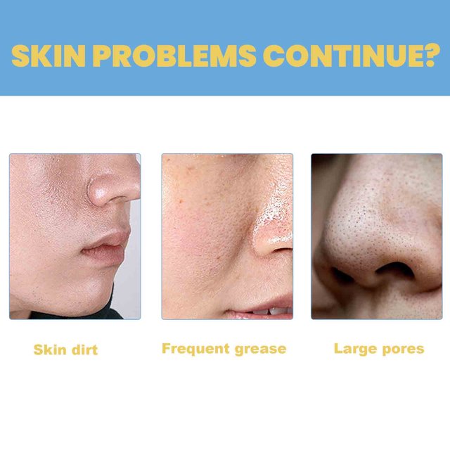 Clarifying Serum Salicylic Acid & Niacinamide Pore-Tightening