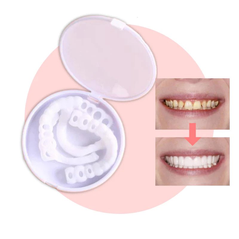 Cosmetic Veneers Snap-On Flexible Upper & Lower Set