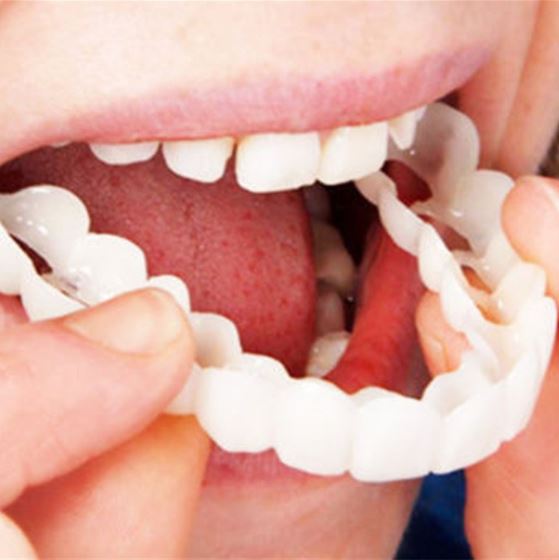 Cosmetic Veneers Snap-On Flexible Upper & Lower Set