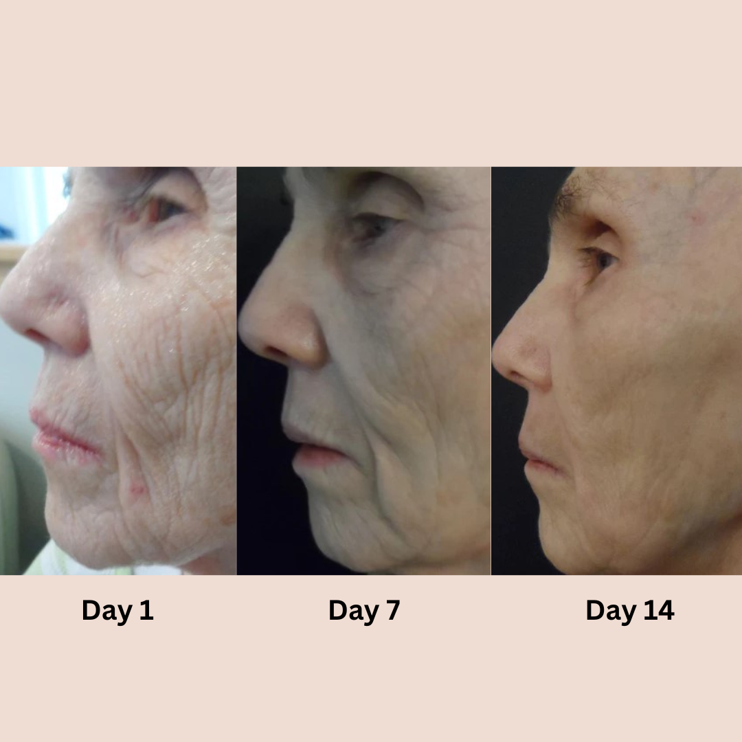 Eye Cream Anti-Aging Lifting Hyaluronic Acid & Venom Essence