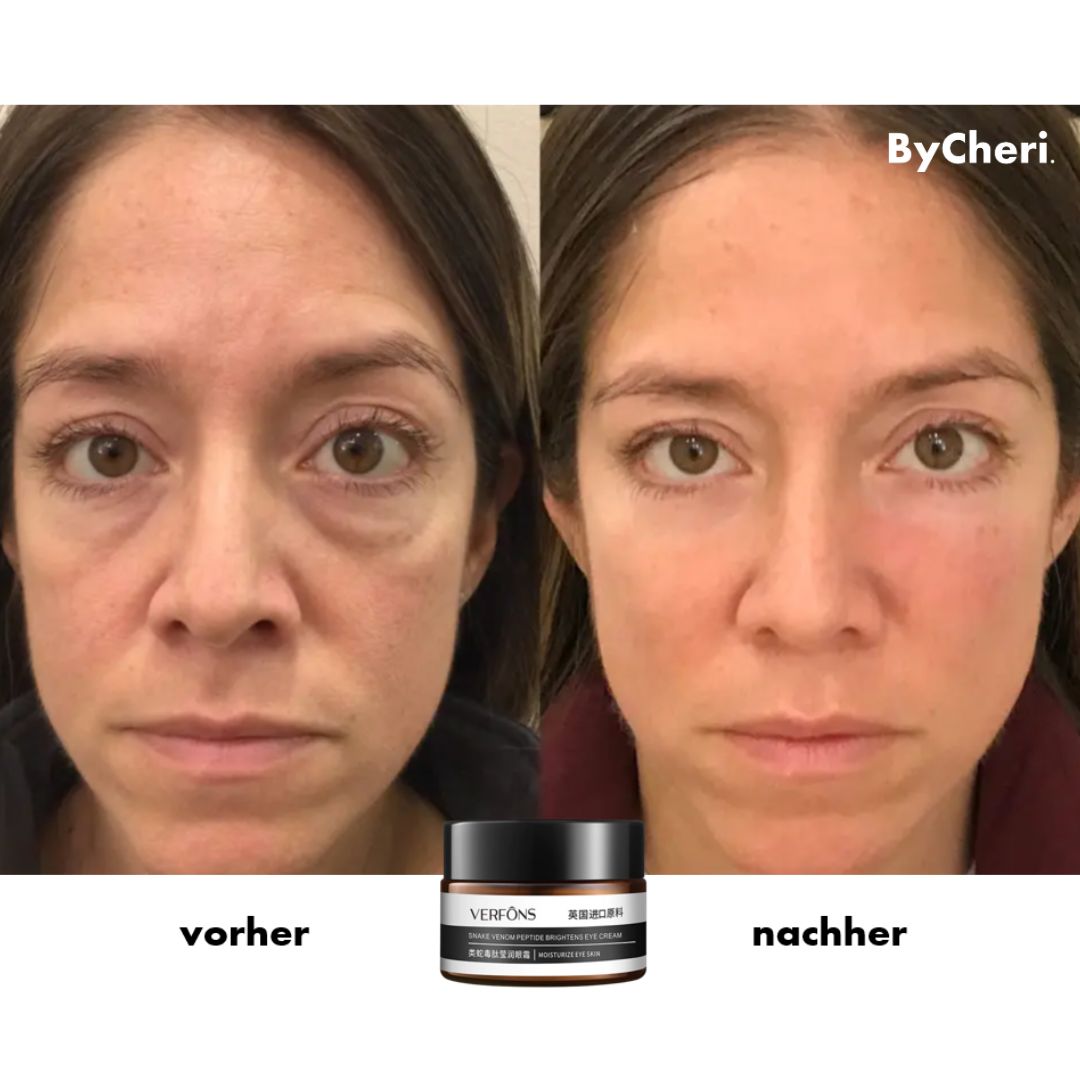 Eye Cream Instant Tightening Snake Peptide & Niacinamide