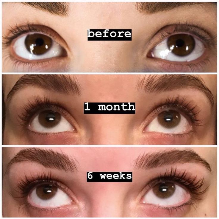 Eyelash Serum Longer & Thicker Lashes Lightweight Gentle Formula
