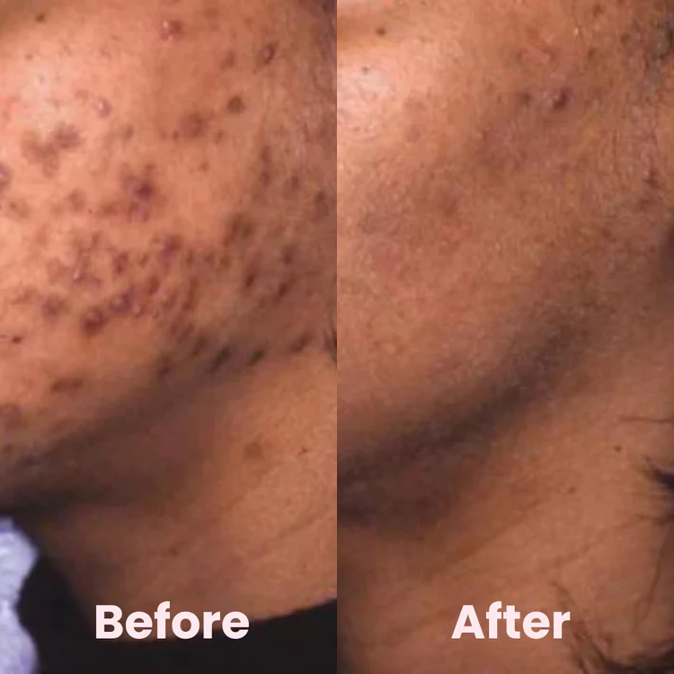 Facial Brightening Pads Turmeric & Kojic Acid
