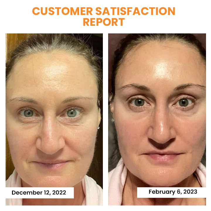 Facial Collagen Film Soluble Hyaluronic Acid & Marine Collagen