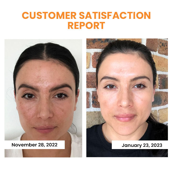 Facial Collagen Film Soluble Hyaluronic Acid & Marine Collagen
