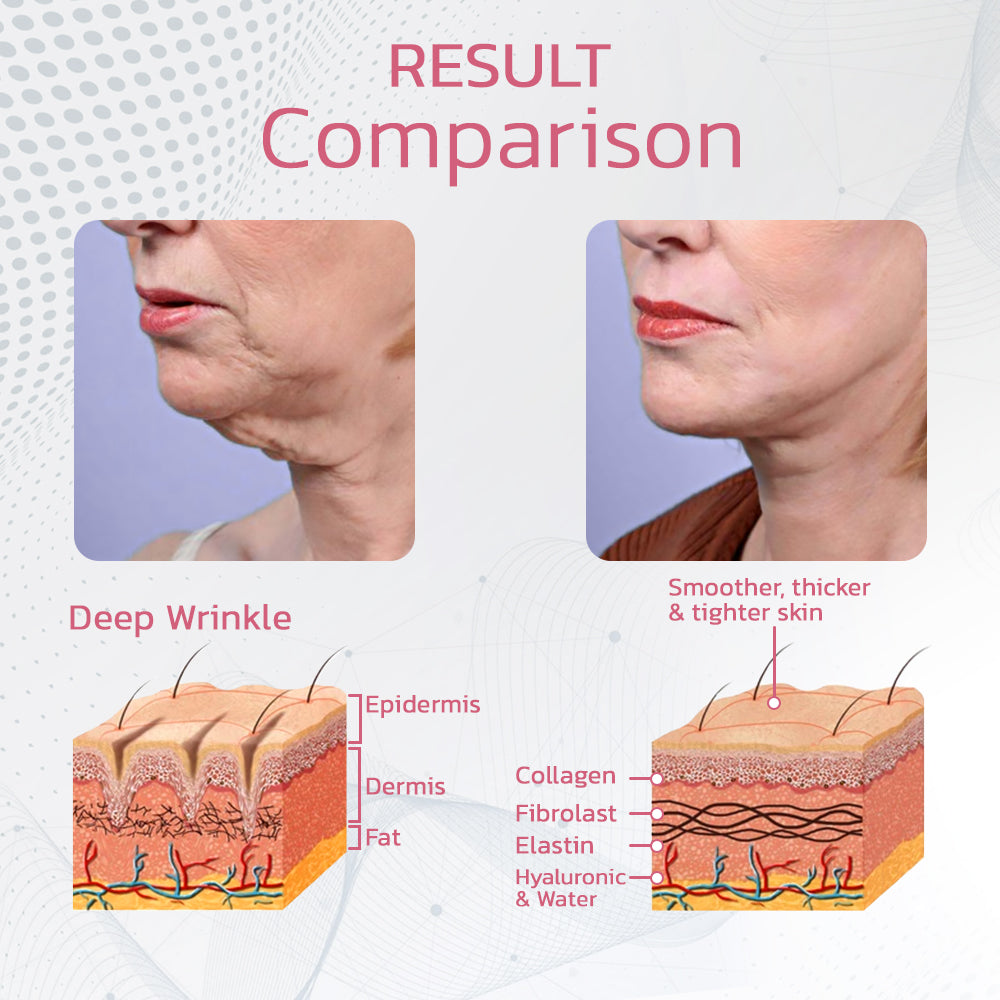 Facial Lymphatic Massager Pulse Vibration Rechargeable