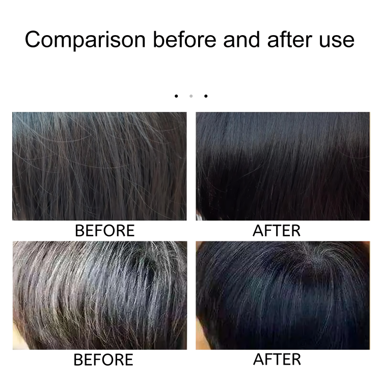 Gray Hair Treatment Restores Natural Color Natural Ingredients