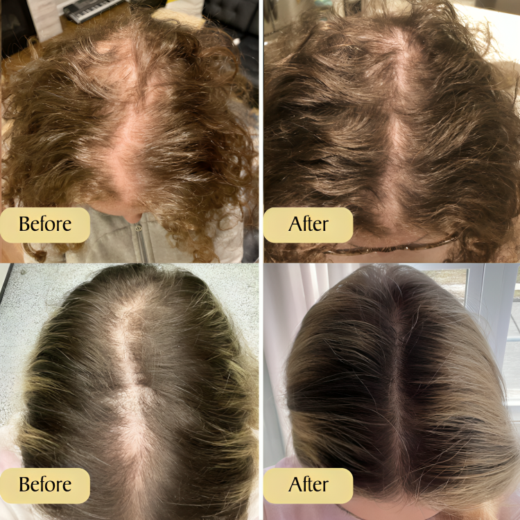 Hair Growth Oil Vegan Plant-Based Strengthens & Nourishes
