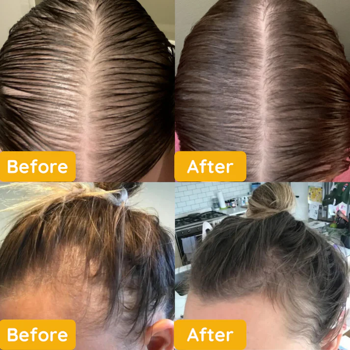 Hair Oil Thicker & Stronger Overnight Treatment