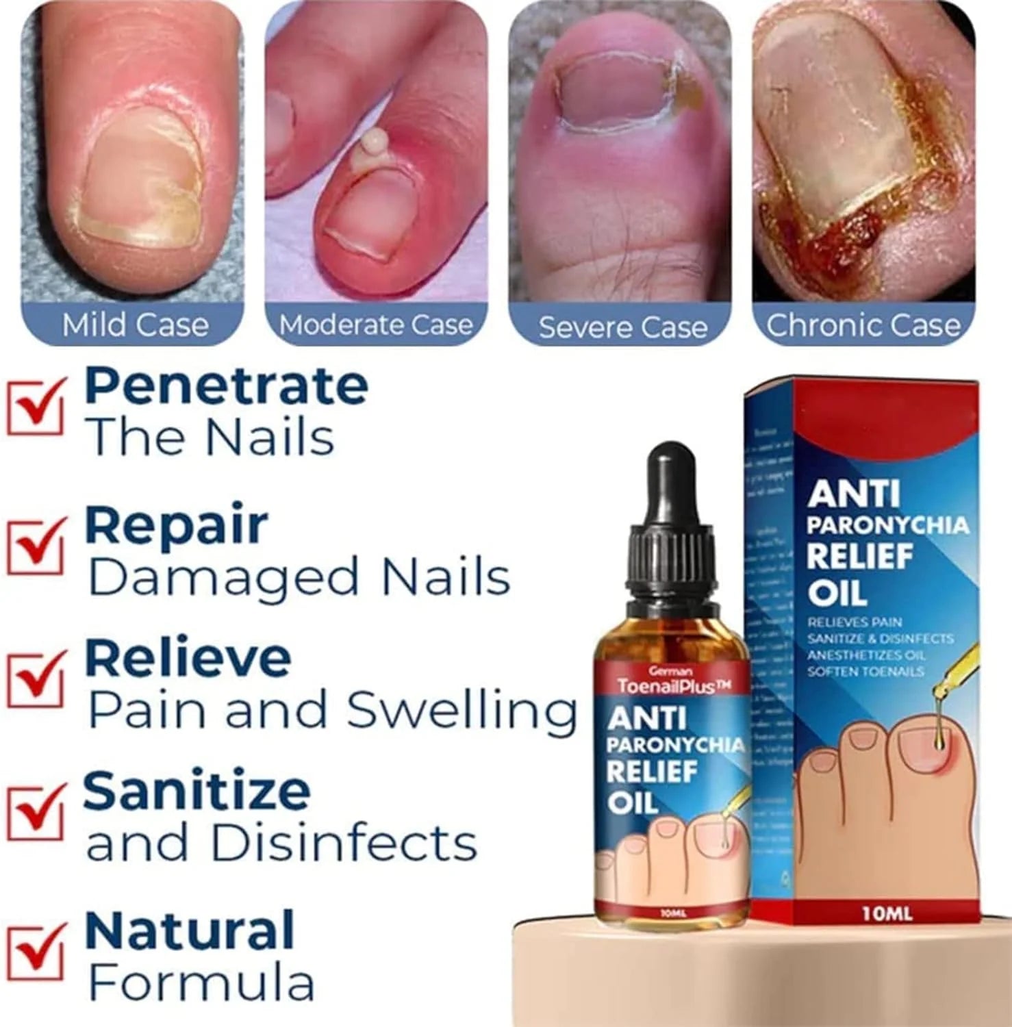 Nail & Cuticle Oil Clove & Shea Butter