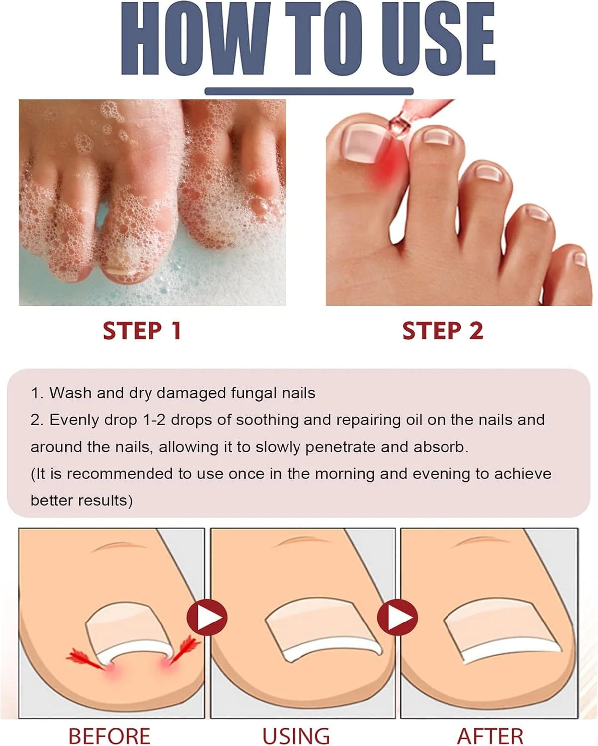 Nail & Cuticle Oil Clove & Shea Butter