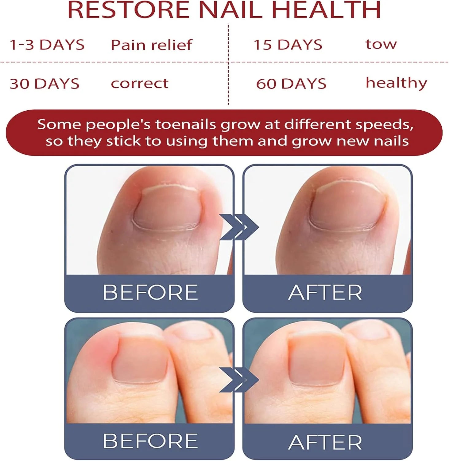 Nail & Cuticle Oil Clove & Shea Butter
