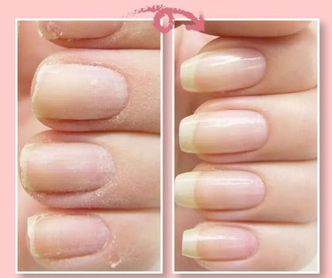 Nail Repair Gel Instant Clear Long-Lasting