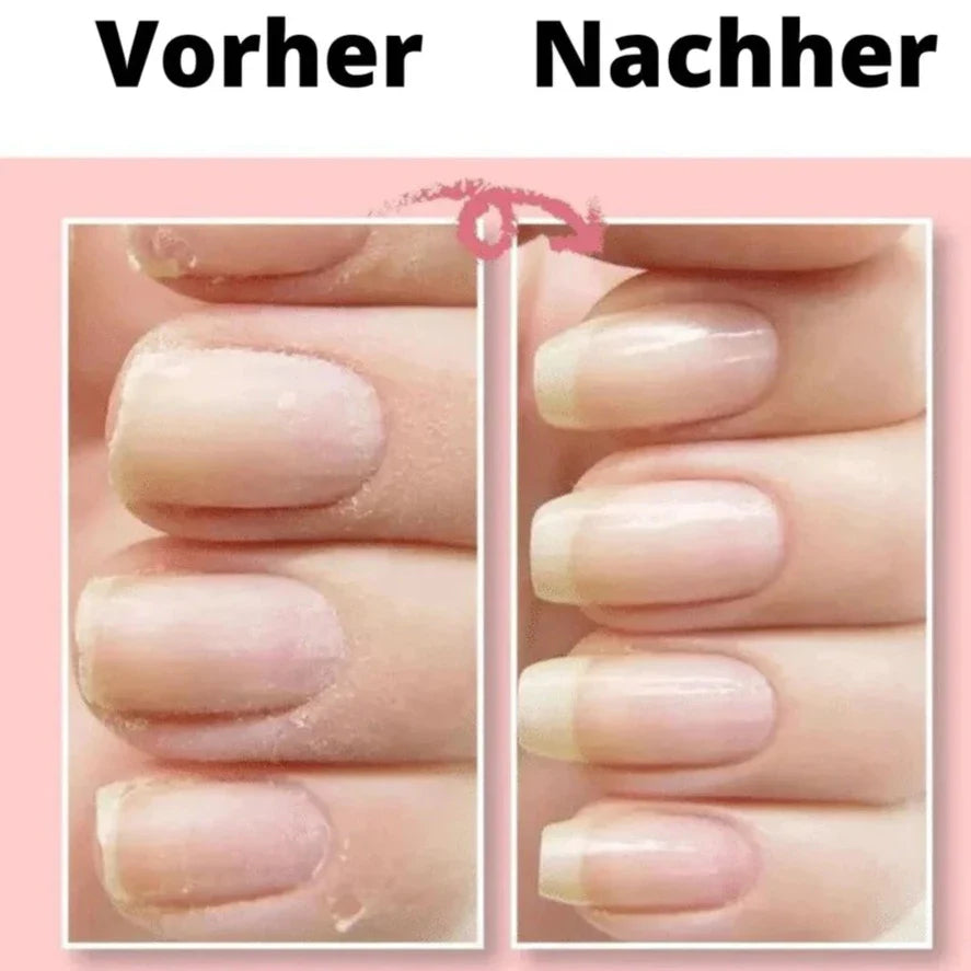 Nail Repair Gel Strengthening Fiber Fast-Drying Long-Lasting
