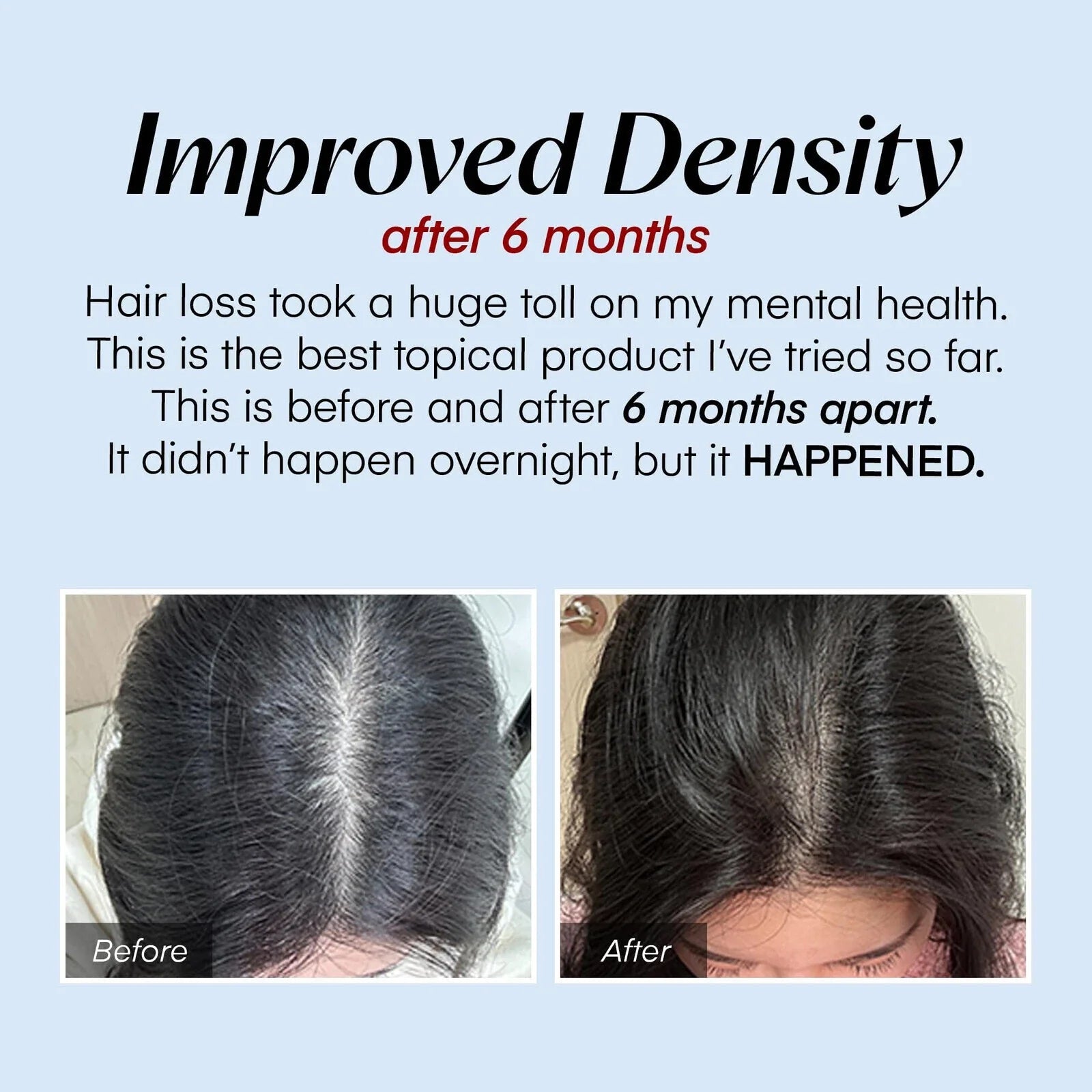 Scalp Serum Roller Applicator Oil Control & Root Strengthening