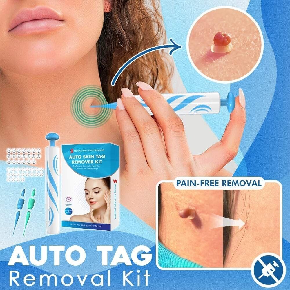 Skin Fibroma Removal Kit Non-Surgical Ligature Bands & One-Handed Applicator