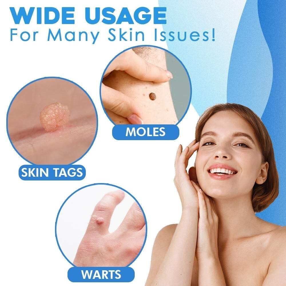 Skin Fibroma Removal Kit Non-Surgical Ligature Bands & One-Handed Applicator
