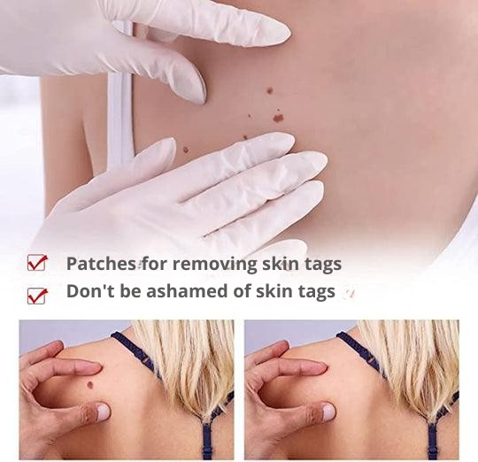 Skin Spot & Wart Remover Precision Applicator Plant-Based Pain-Free