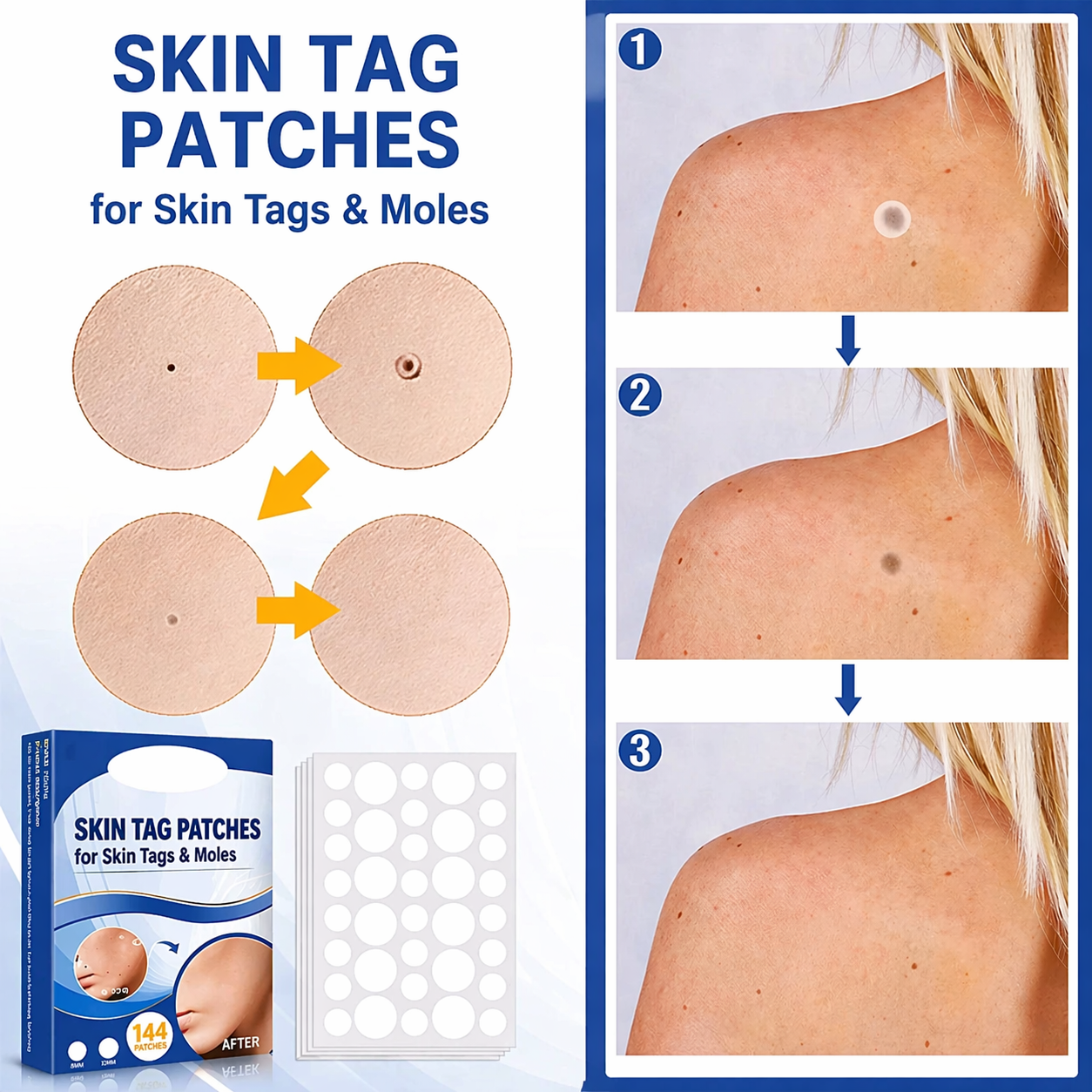 Skin Tag Removal Patches Ultra-Thin Transparent 144 Pack
