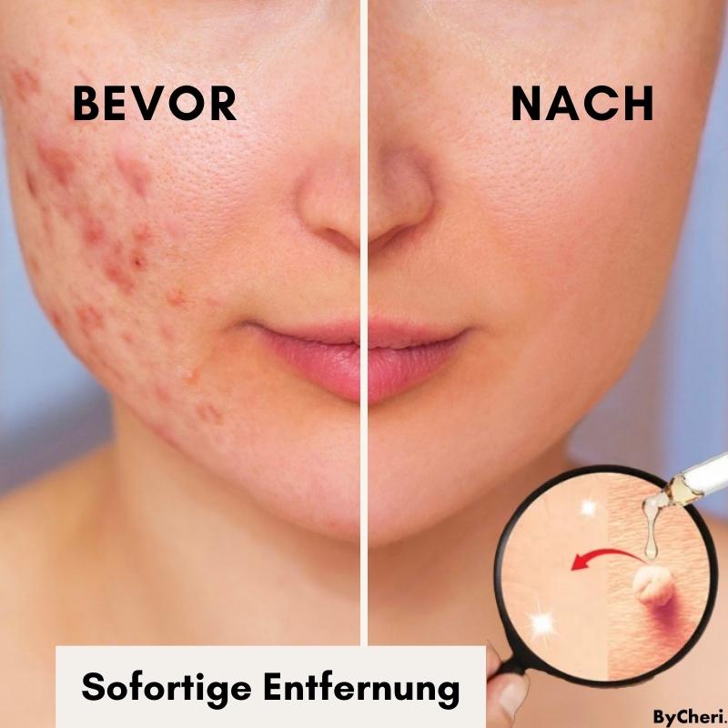 Spot & Blemish Serum Natural Botanical Face & Body
