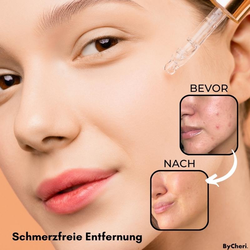 Spot & Blemish Serum Natural Botanical Face & Body