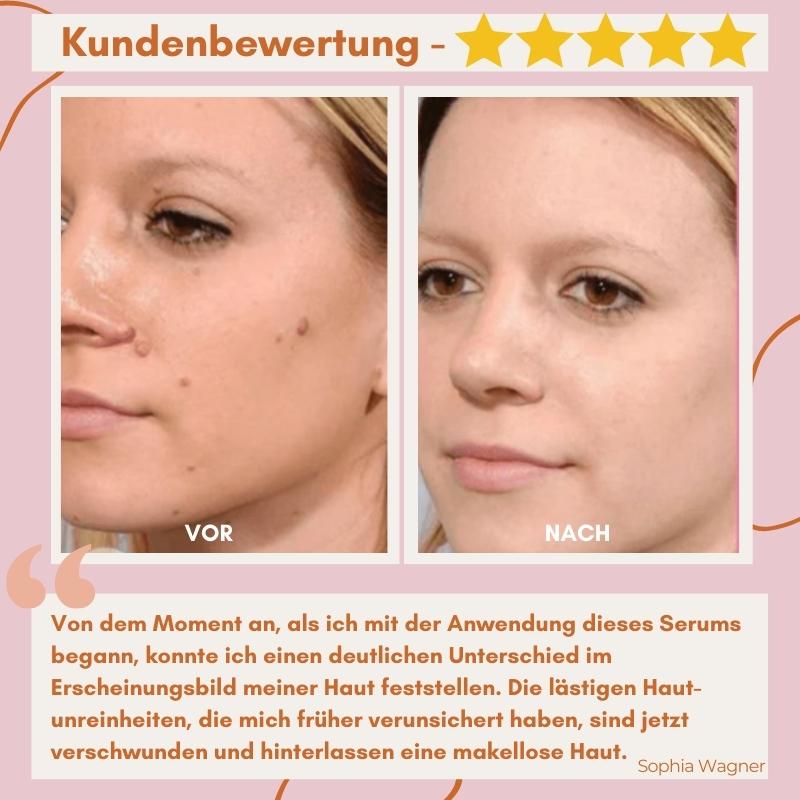 Spot & Blemish Serum Natural Botanical Face & Body
