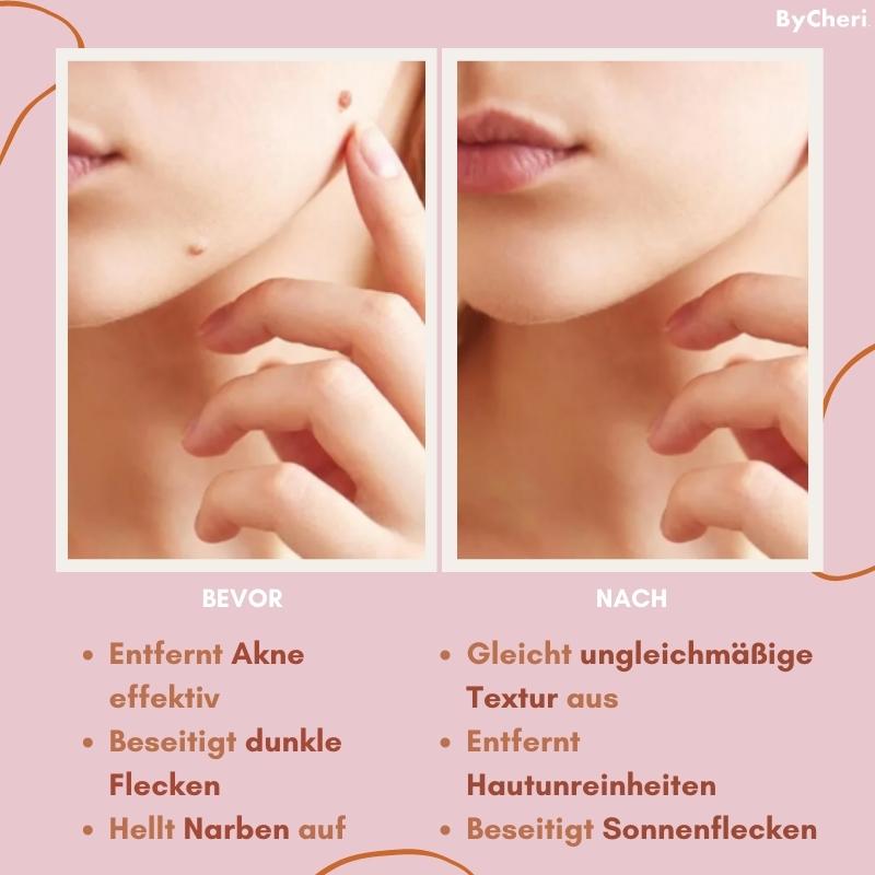 Spot & Blemish Serum Natural Botanical Face & Body