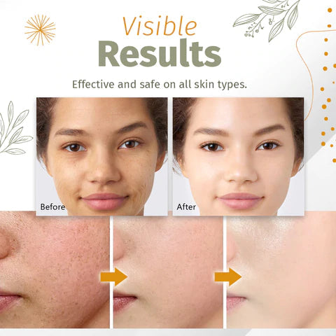 Spot Removal Serum Organic Fast-Acting Face & Body