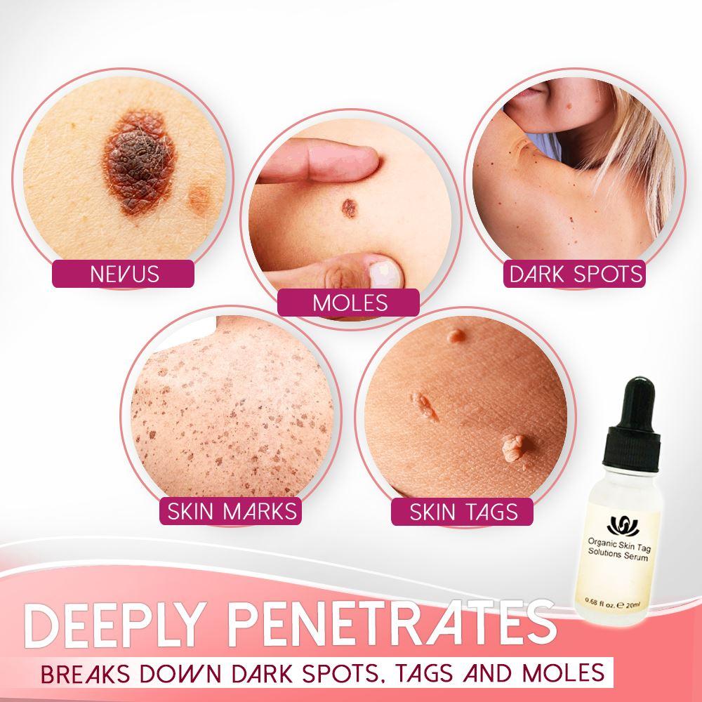 Spot Removal Serum Organic Fast-Acting Face & Body