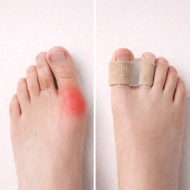 Toe Spacer Soft Gel Bunion Relief Set of 2